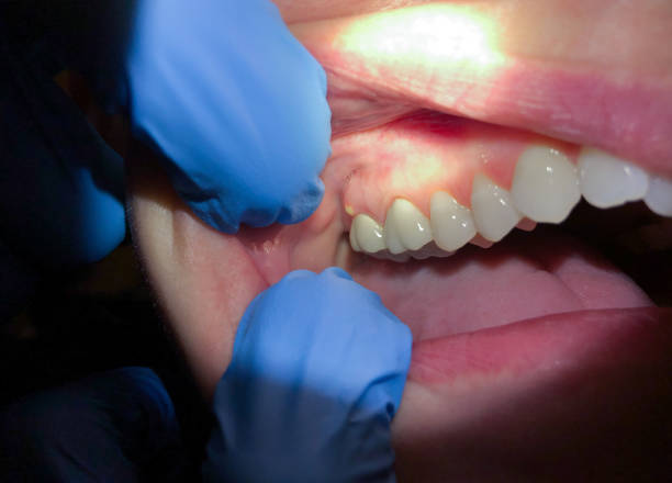 Best Emergency Dentist for Knocked-Out Tooth in Nolensville, TN